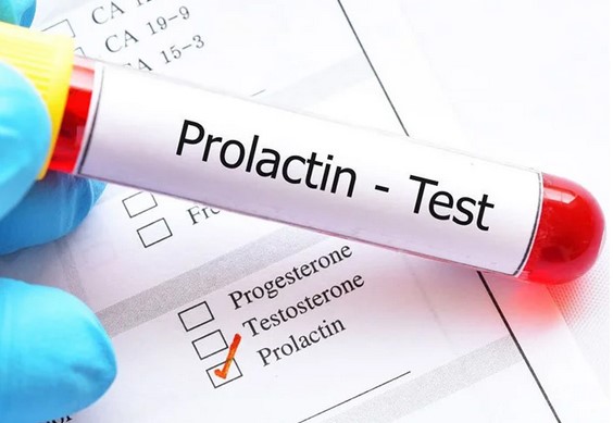 Что такое пролактин?