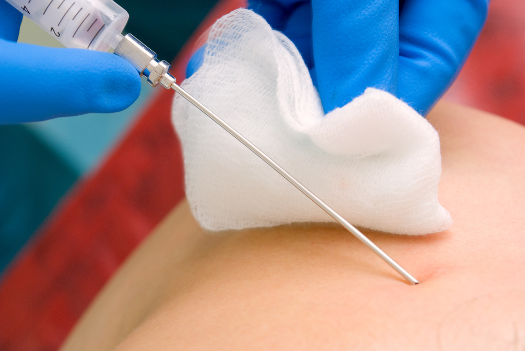 результати біопсії