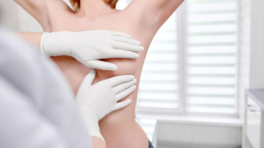 Фото Перидуктальний мастит