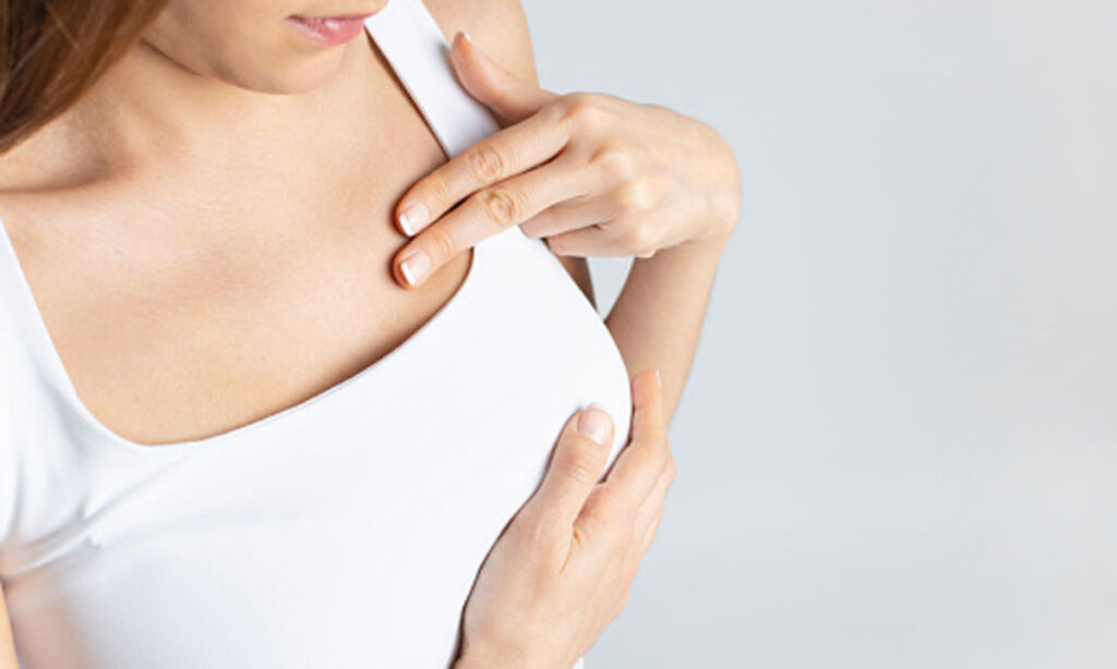 Фото Лобулярний рак молочної залози