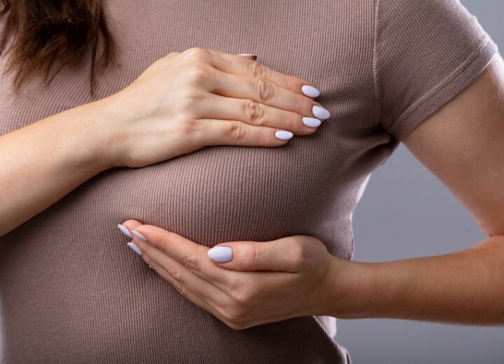 Фото Порушення архітектоніки молочної залози