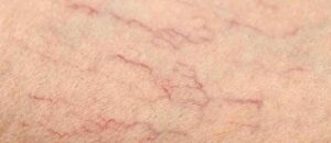 видно вени на грудях - фото 15806