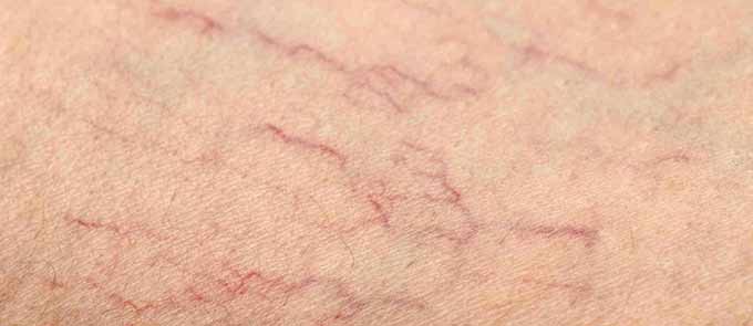 видны вены на груди - фото 15803